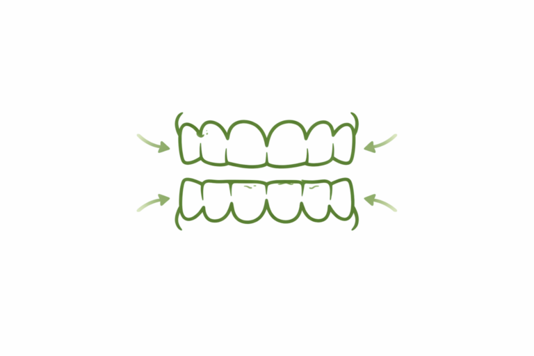 Clenching and grinding